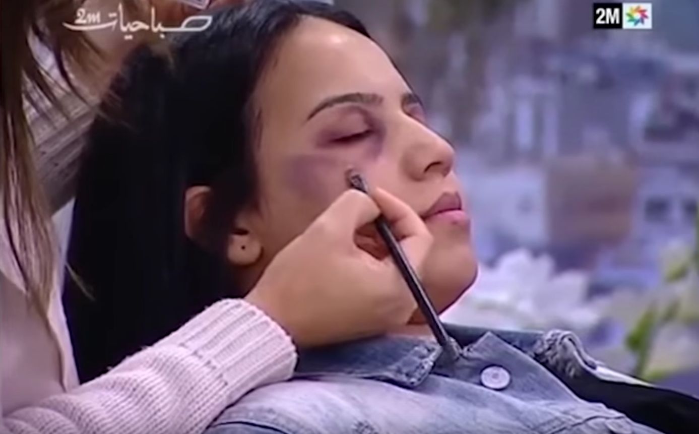 Marokański program pokazał, jak ukryć siniaki pod makijażem