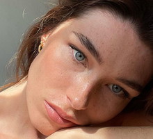 blackheads