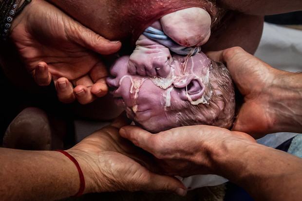 2019 Birth Becomes Her Image Contest