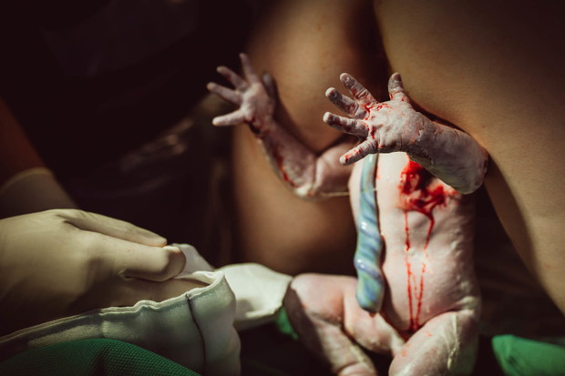 2019 Birth Becomes Her Image Contest