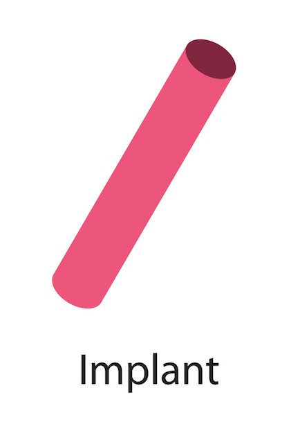 IMPLANT PODSKÓRNY