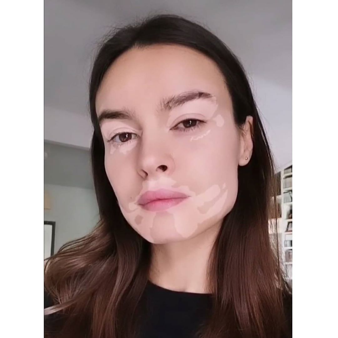 Kasia Smutniak stworzyła filtr na Instagramie, który wspiera osoby chorujące ba bielactwo