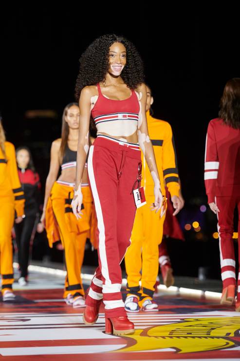 winnie-harlow3-6668af2
