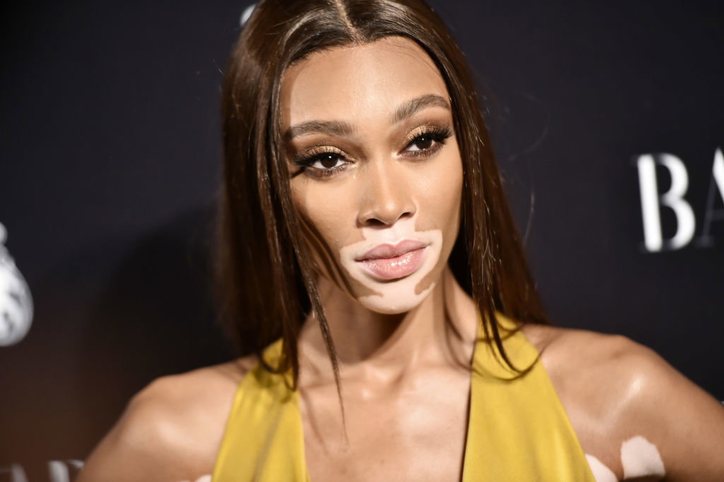 Winnie Harlow