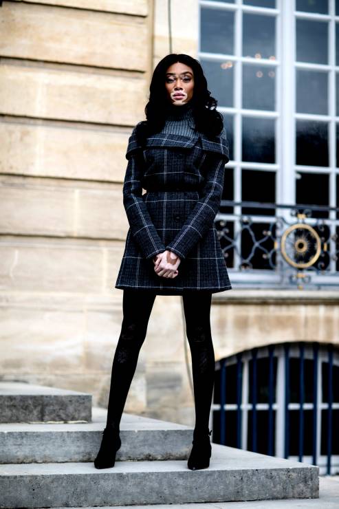 winnie-harlow2-e5e3201