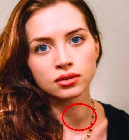 Pewna aktorka ostrzega przed rakiem tarczycy. Jej zdjęcie obiegło sieć, fot. Twitter @LornaNBrown