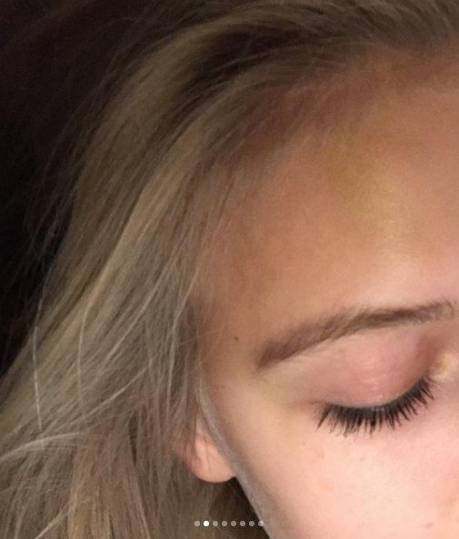 Pobita Nina Tarczyńska - zdjęcia z jej profilu na instagramie