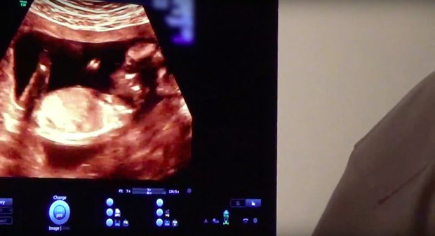 Kylie Jenner urodziła córkę. 20-letnia gwiazda została mamą! Kadr z filmu To Our Daughter