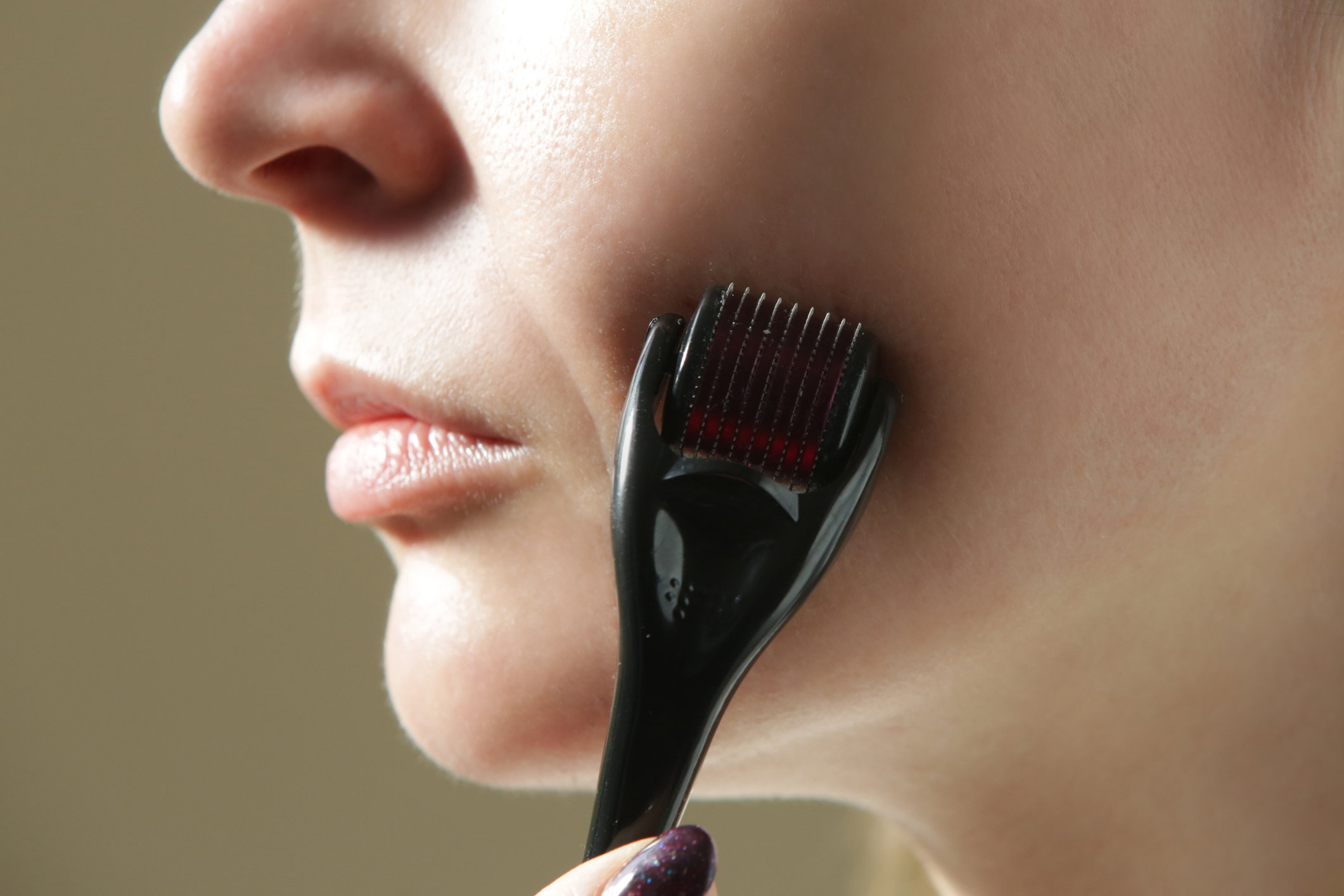 Derma roller