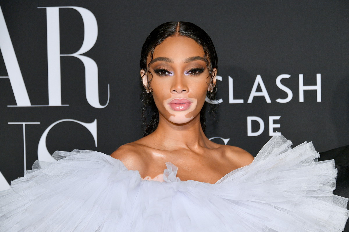 Winnie Harlow