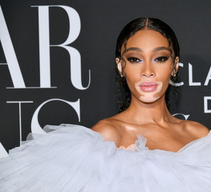 Winnie Harlow