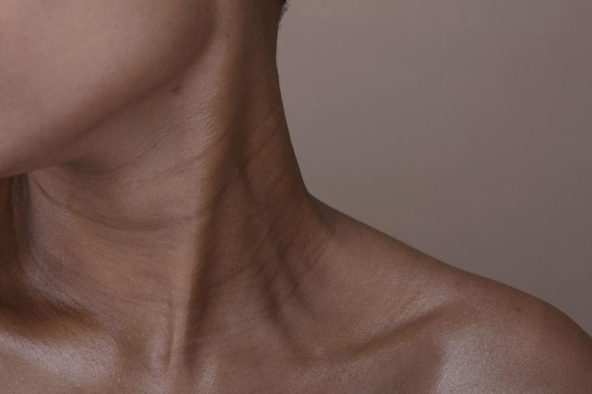 Tech Neck Wrinkles to nowe zmarszczki XXI wieku