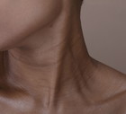 Tech Neck Wrinkles to nowe zmarszczki XXI wieku