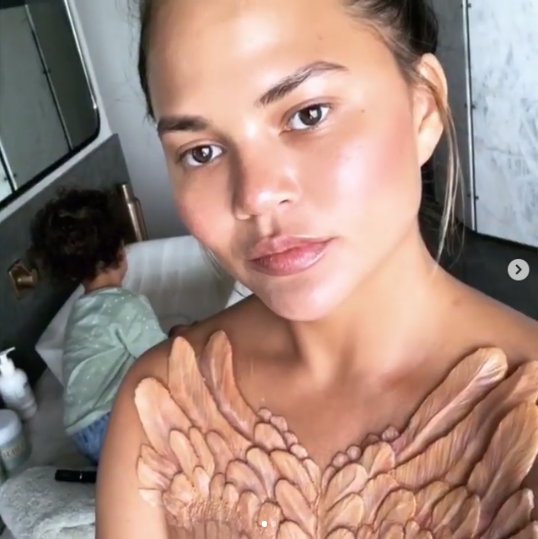 Chrissy Teigen i implant skrzydeł