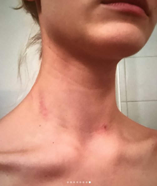 Pobita Nina Tarczyńska - zdjęcia z jej profilu na instagramie