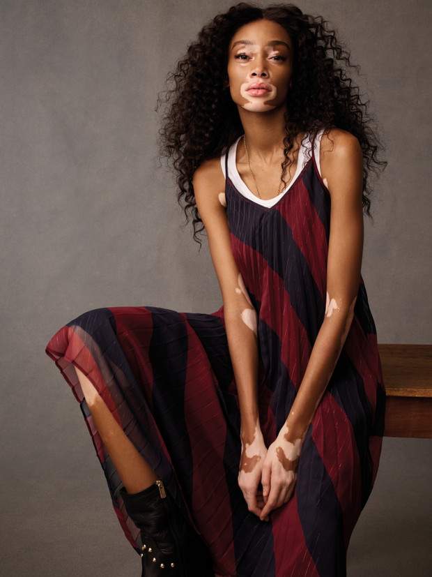 Winnie Harlow ambasadorką marki Tommy Hilfiger