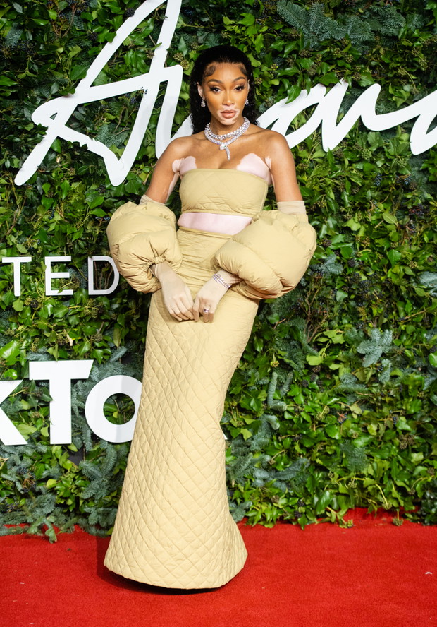 Winnie Harlow
