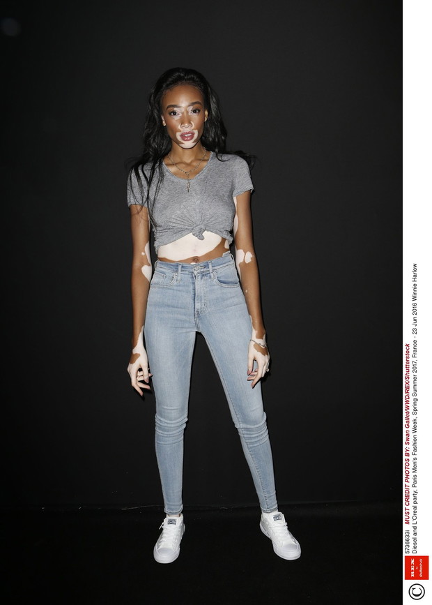 Winnie Harlow