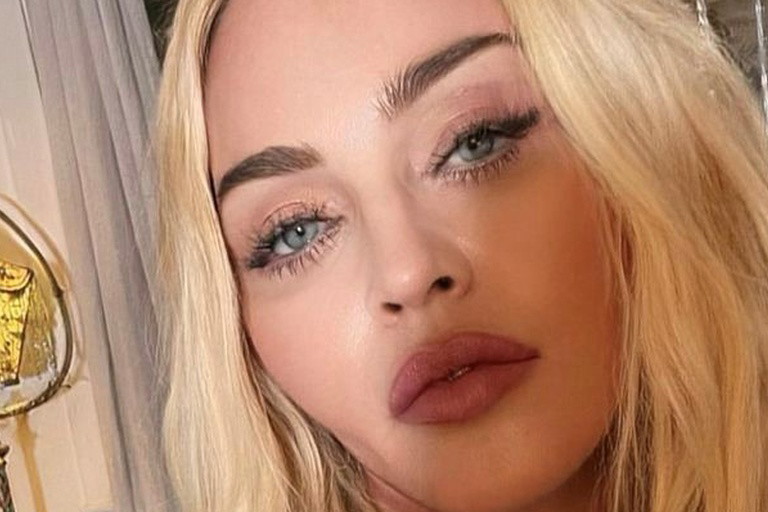 IG