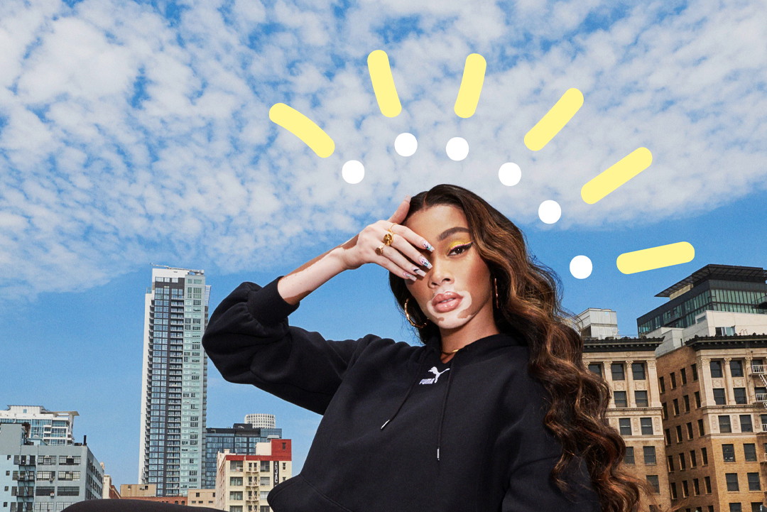 Winnie Harlow to chorująca na bielactwo gwiazda amerykańskiej edycji Top Model, która została ambasadorką nowego modelu butów marki PUMA Cruise Rider