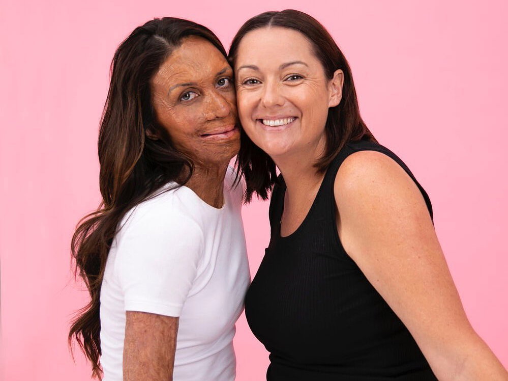 Celeste Barber i Turia Pitt