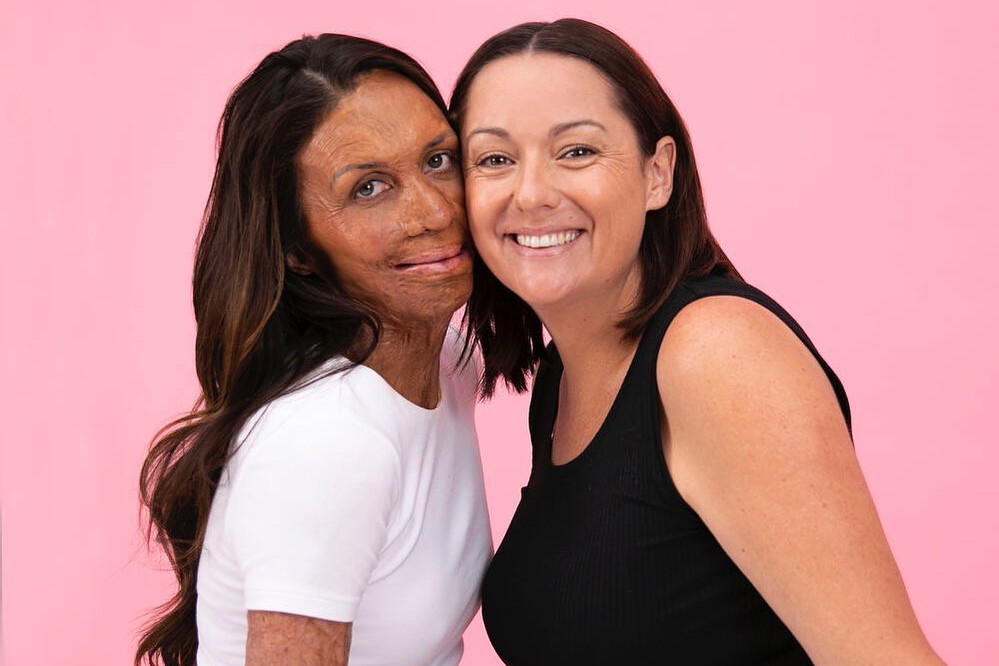 Celeste Barber i Turia Pitt