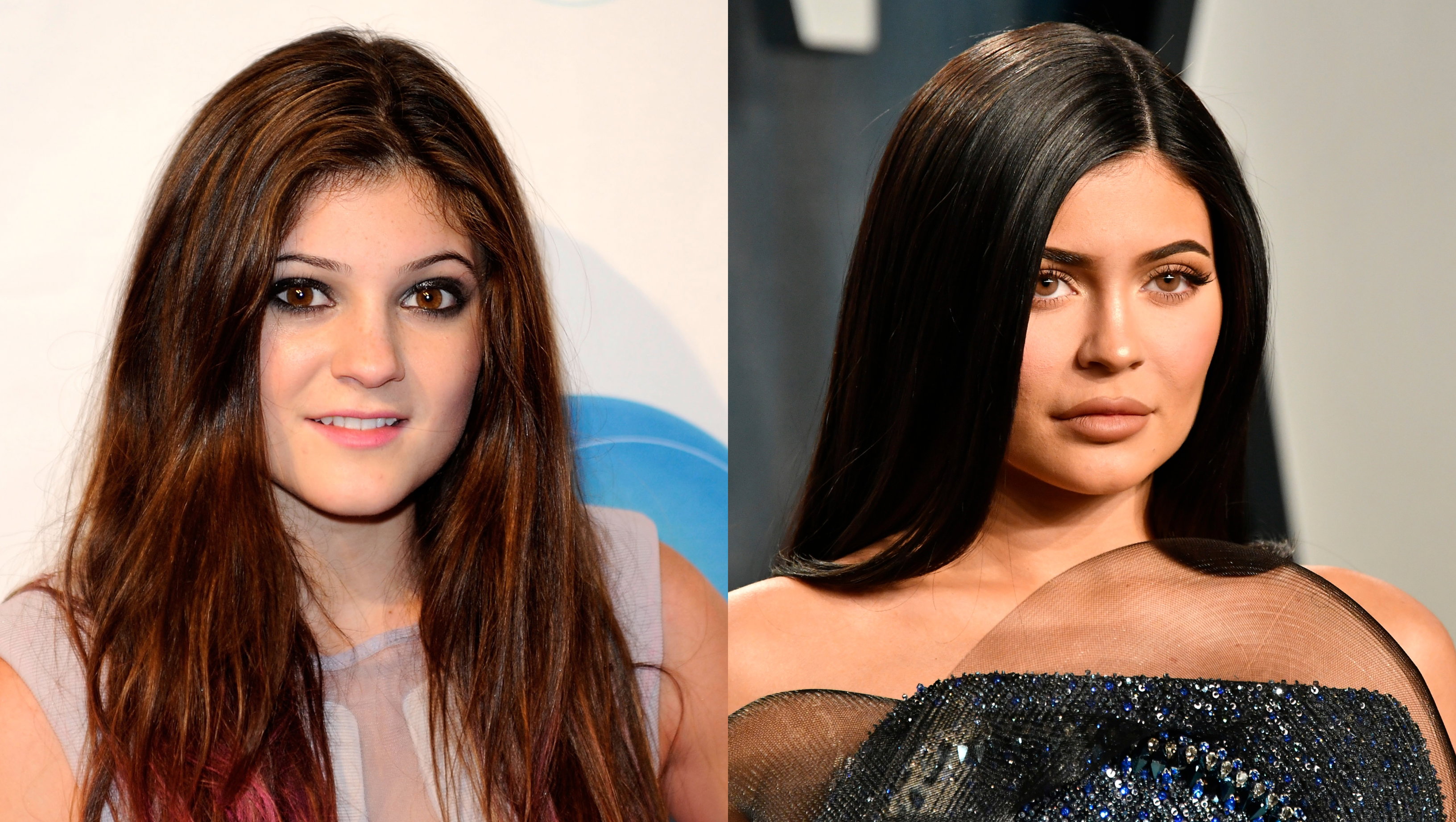 kylie-jenner-zaluje-operacji-plastycznych-nie-chce-zeby-moja-corka-robila-to-co-ja1-8069438