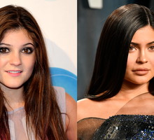 kylie-jenner-zaluje-operacji-plastycznych-nie-chce-zeby-moja-corka-robila-to-co-ja1-8069438