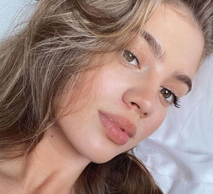 Uczestniczka „Top Model” Weronika Zoń wyznała, że jeszcze rok temu zmagała się z trądzikiem. I pokazała, jak wyglądała jej cera
