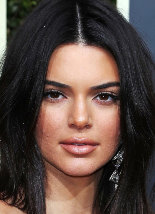 Kendall Jenner z trądzikiem na Złotych Globach