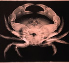 X-ray of crab (Decapoda) (B&W)