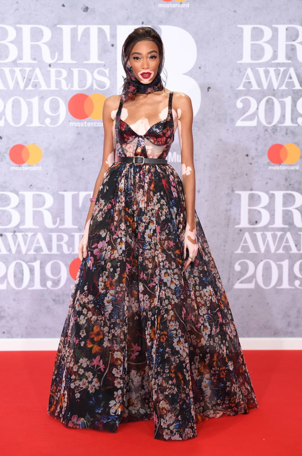 Winnie Harlow