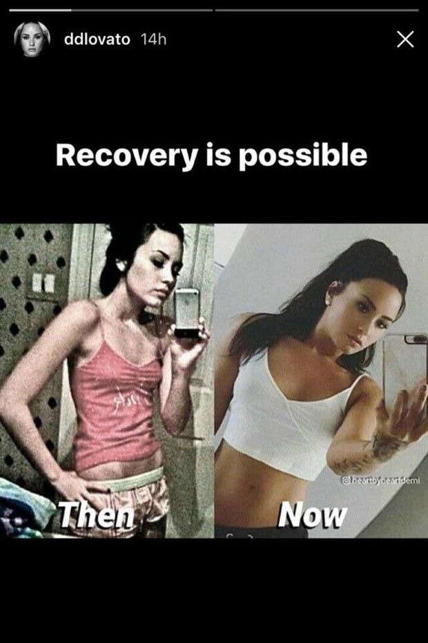 Demi opublikowała na InstaStories zdjęcie z okresu choroby
