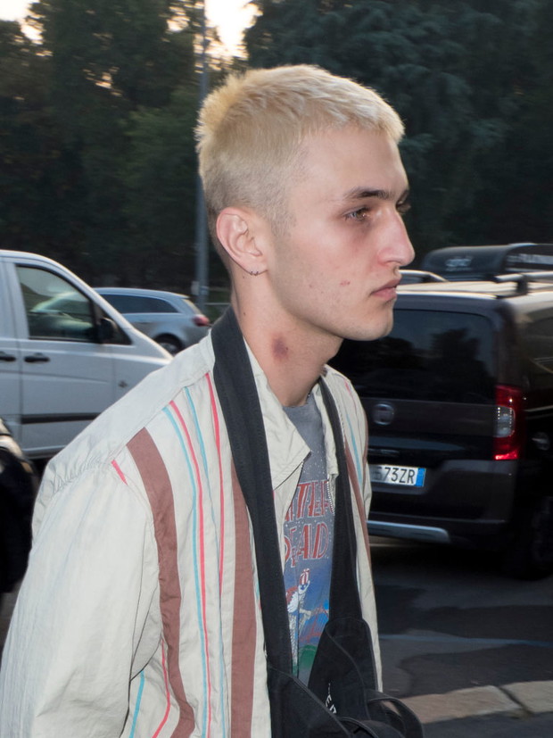 Praktycznie w tym samym czasie Anwar Hadid widziany był z podobnym znamieniem na szyi. Przypadek?