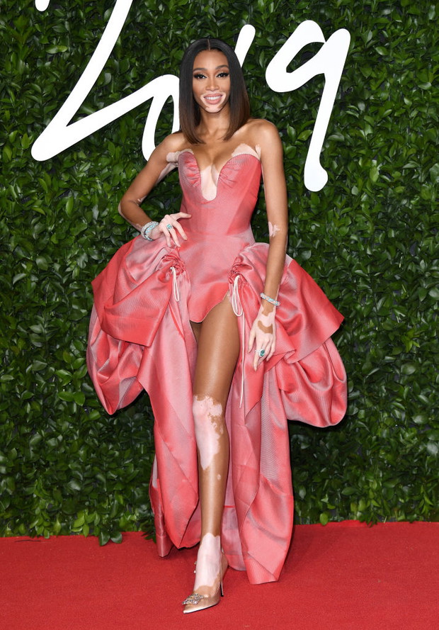 Winnie Harlow