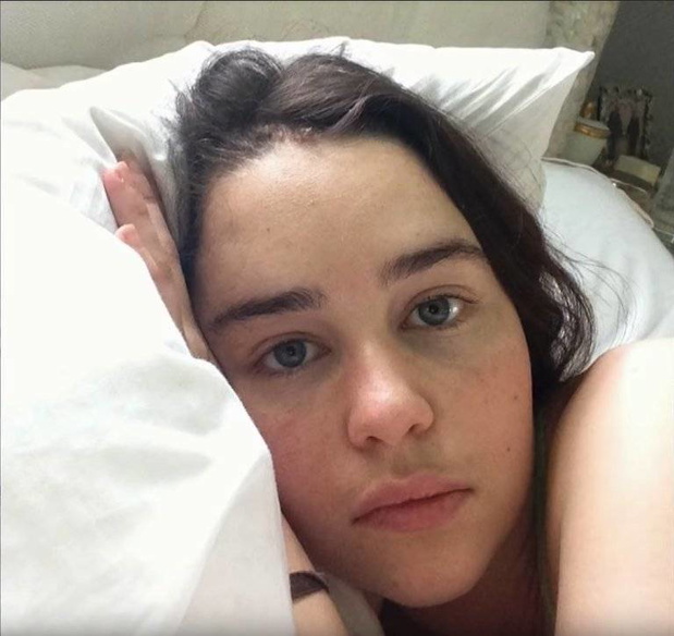 Emilia Clarke przeszła 3 operacje mózgu.
