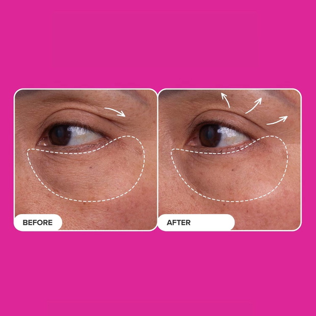 Serum peptydowe pod oczy