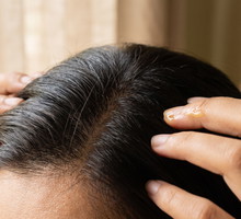 Scalp Spa