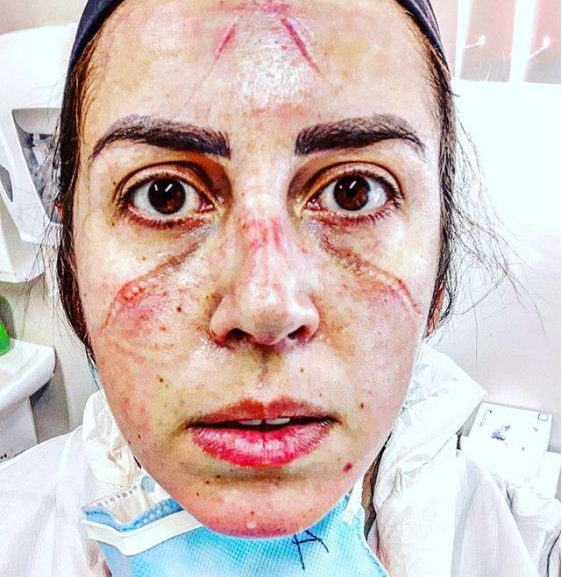 zdjęcia pielęgniarek