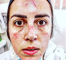 zdjęcia pielęgniarek