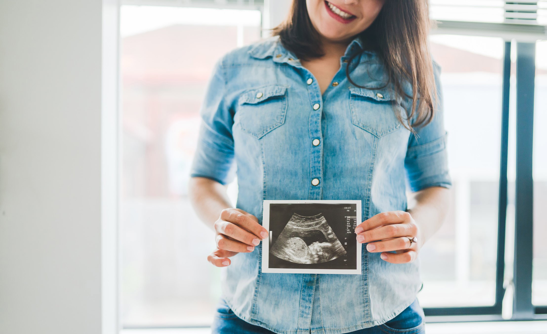 Woman with pregnancy scan in her hand.