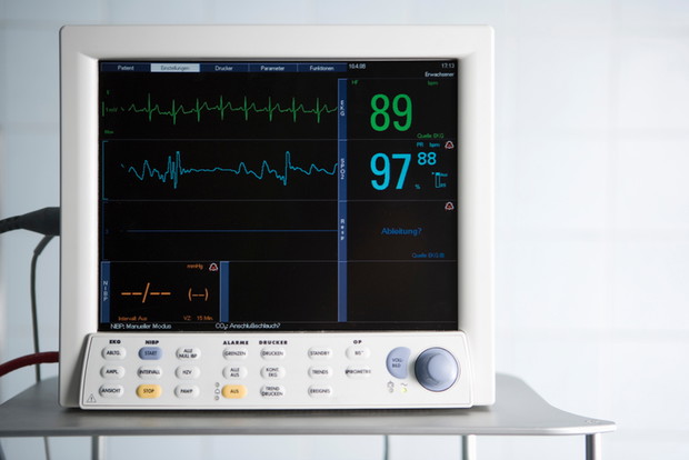 EKG