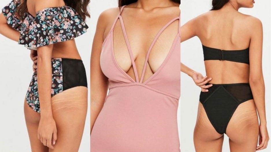 Modelki z rozstępami w kampanii Missguided