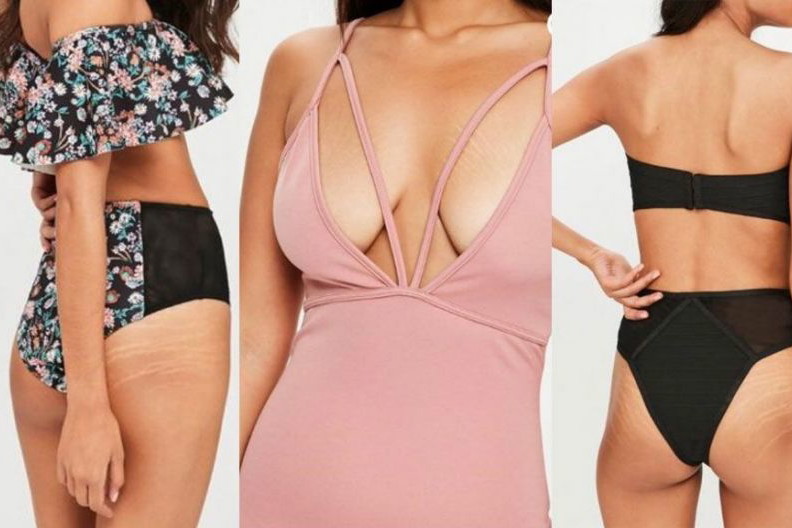 Modelki z rozstępami w kampanii Missguided