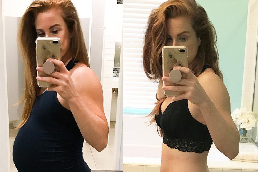 Nancy Anderson schudła po ciąży dzięki oddychaniu