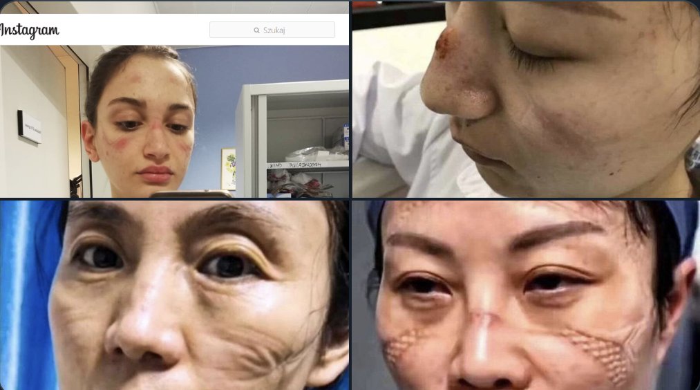 Najpiękniejsze kobiety świata: zdjęcia lekarek i pielęgniarek po wielogodzinnych dyżurach w szpitalach na świecie