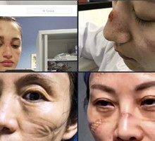 Najpiękniejsze kobiety świata: zdjęcia lekarek i pielęgniarek po wielogodzinnych dyżurach w szpitalach na świecie