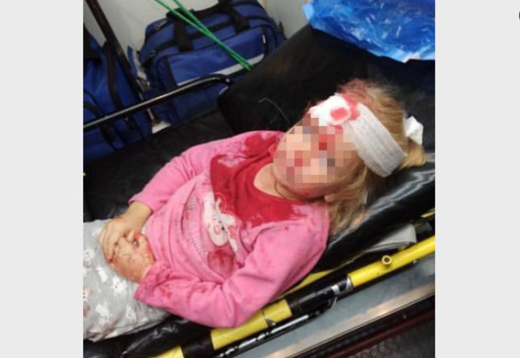 Dziewczyna została ranna podczas protestów