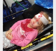 Dziewczyna została ranna podczas protestów