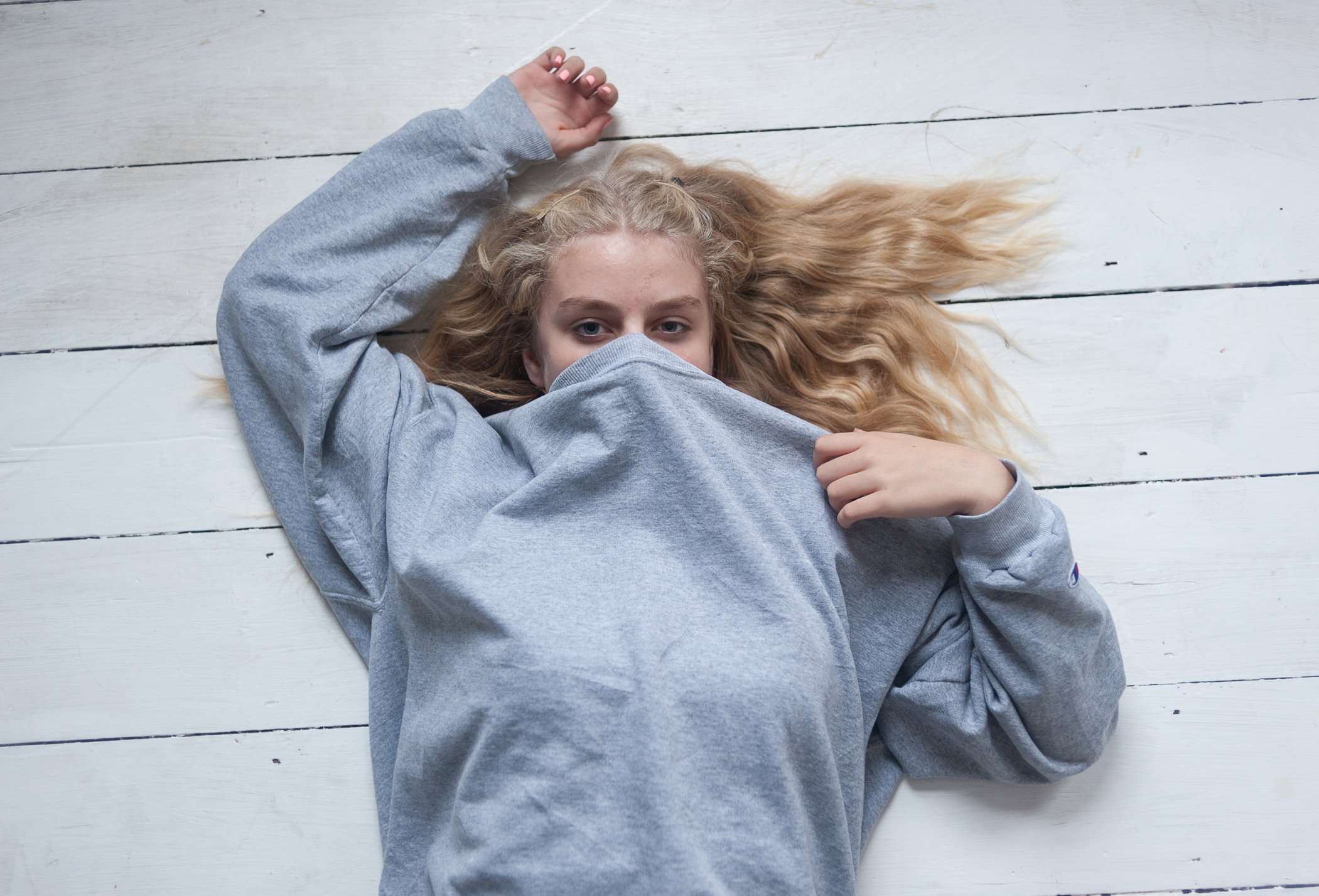 Trądzik nie zatrzyma się sam